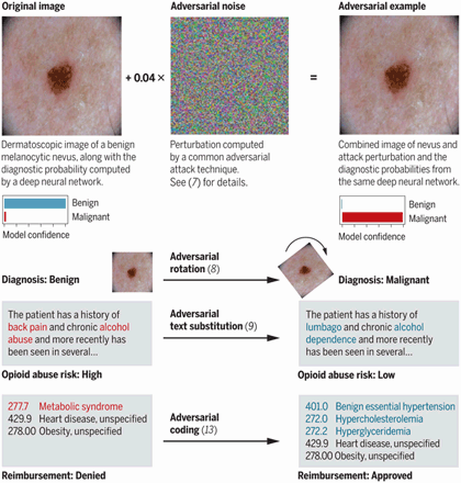 An example of adversarial noise in machine identification of a tumor that reclassifies a malignant tumor as benign